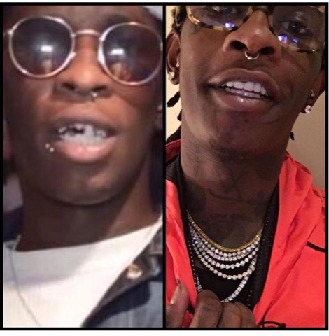 thug-teeth