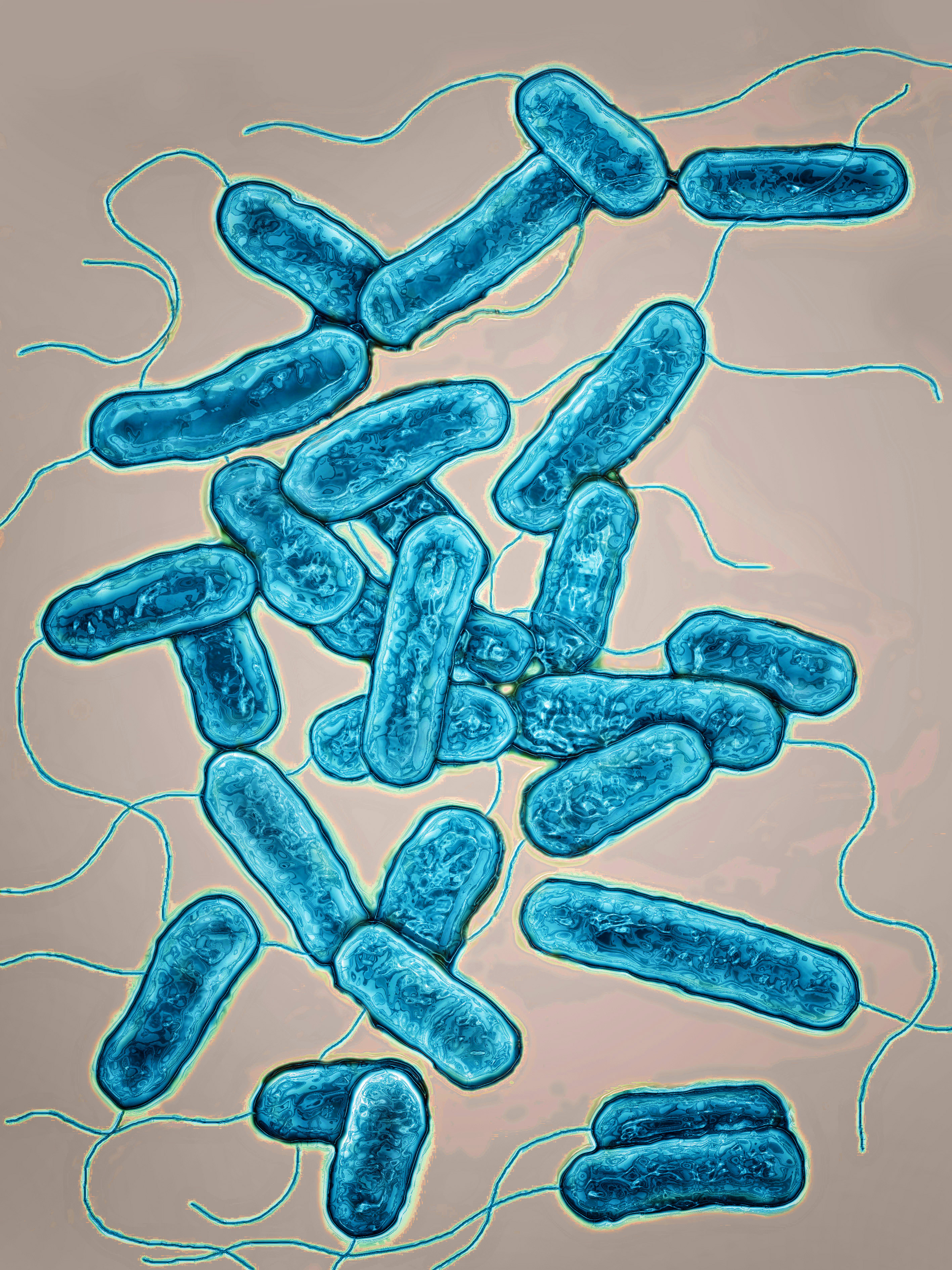 Legionella pneumophila
