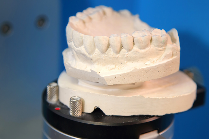 Ceramic dental crowns for implants. Fabrication of dental crowns and dentures made of ceramic. Scanning of plaster casts of teeth.